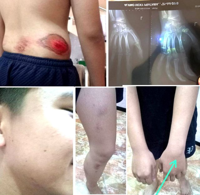 Oknum Polisi Polrestabes Surabaya Diduga Aniaya Anak Dibawa Umur, Orang Tua Korban Laporkan ke Propam