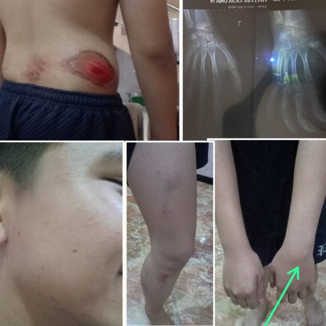 Terima SP2HP, Pelapor Tunggu Gelar Perkara Kasus Dugaan Tindak Pidana Kekerasan Terhadap Anak